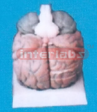 SUPER BRAIN MODEL (12PCS)